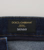 Dolce & Gabbana Dark Blue Cotton Denim SKINNY Jeans